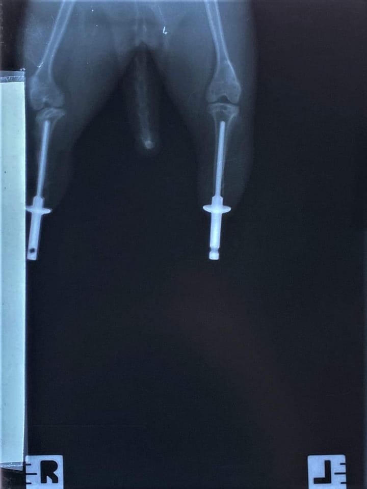 Rentgen Mojita s protézkami